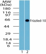 Western blot of Frizzled-10 in human brain lysate. Lane 1 shows pre-immune sera and Lanes 2 show LS-C47364 tested on human at 1:1000 dilution.