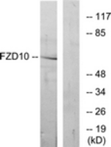 Western blot of extracts from COS7 cells, using FZD10 Antibody. The lane on the right is treated with the synthesized peptide.