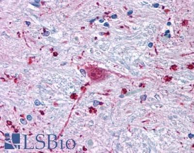 Anti-FZD3 / Frizzled 3 antibody LS-A4437 IHC of human brain, neurons and glia. Immunohistochemistry of formalin-fixed, paraffin-embedded tissue after heat-induced antigen retrieval.