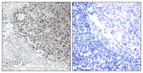 IHC of paraffin-embedded human tonsil tissue, using Collagen IX alpha3 Antibody. The picture on the right is treated with the synthesized peptide.