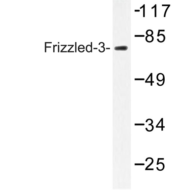 Western blot of Frizzled-3 (L180) pAb in extracts from A549 cells.