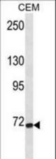 FZD3 Antibody western blot of CEM cell line lysates (35 ug/lane). The FZD3 antibody detected the FZD3 protein (arrow).