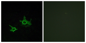 Immunofluorescence of COS7 cells, using FZD3 Antibody. The picture on the right is treated with the synthesized peptide.