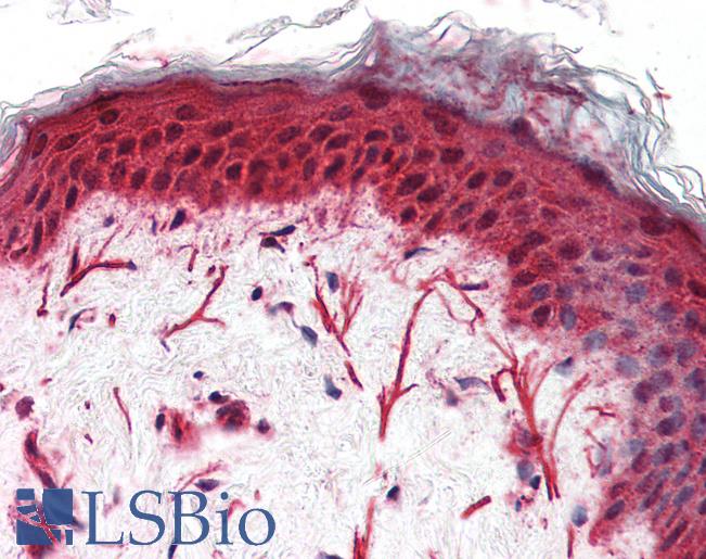 Anti-FZD3 / Frizzled 3 antibody LS-A4434 IHC of human skin. Immunohistochemistry of formalin-fixed, paraffin-embedded tissue after heat-induced antigen retrieval.
