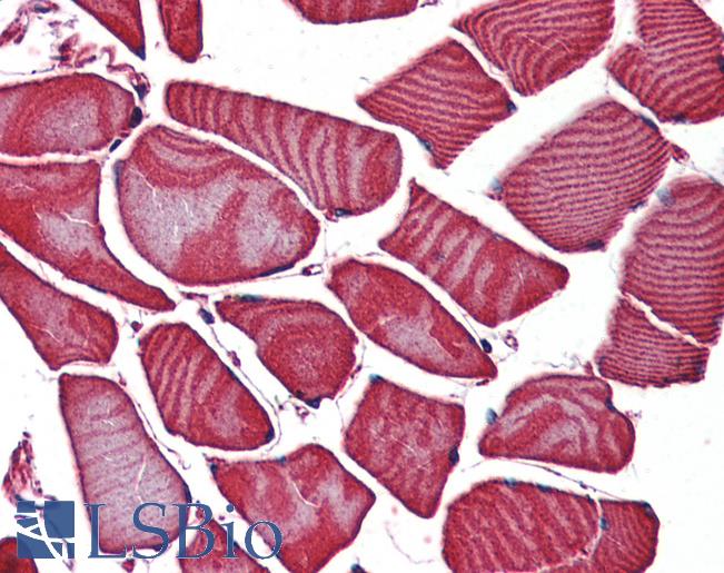 Anti-FZD3 / Frizzled 3 antibody LS-A4434 IHC of human skeletal muscle. Immunohistochemistry of formalin-fixed, paraffin-embedded tissue after heat-induced antigen retrieval.