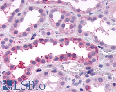 Anti-FZD4 / Frizzled 4 antibody LS-A4911 IHC of human kidney. Immunohistochemistry of formalin-fixed, paraffin-embedded tissue after heat-induced antigen retrieval.