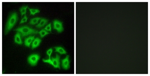 Immunofluorescence of A549 cells, using FZD4 Antibody. The picture on the right is treated with the synthesized peptide.