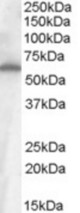 Antibody (1 ug/ml) staining of Small Intestine (Ileum) cell lysate (35 ug protein in RIPA buffer). Primary incubation was 1 hour. Detected by chemiluminescence.
