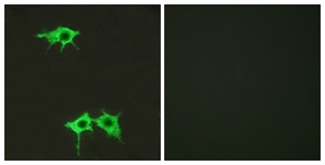 Immunofluorescence of LOVO cells, using FZD4 Antibody. The picture on the right is treated with the synthesized peptide.