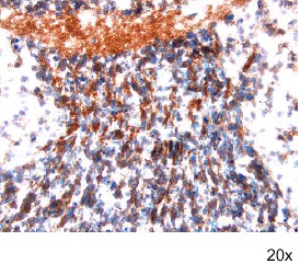 Frizzled-4 in Embryonic Mouse Neuronal Tissue. Frizzled-4 was detected in immersion fixed frozen sections of embryonic mouse neuronal tissue (E11) using 15 ug/ml Goat Anti-Mouse Frizzled-4 Antigen Affinity-purified Polyclonal Antibody overnight at 4°C. Tissue was stained with Anti-Goat HRP-DAB (brown) and counterstained with hematoxylin (blue). Specific labeling was localized to the plasma membrane and cytoplasm of neuronal cells in the midbrain.