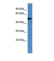 Western blot of Human COLO205. GPCR antibody dilution 1.0 ug/ml.