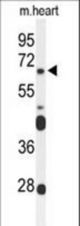 Western blot of FZD4 Antibody in mouse heart tissue lysates (35 ug/lane). FZD4 (arrow) was detected using the purified antibody.