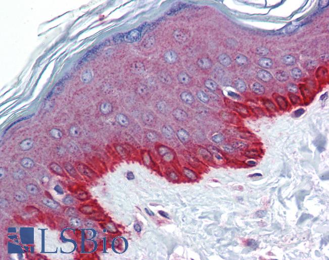 Anti-FZD4 / Frizzled 4 antibody IHC of human skin. Immunohistochemistry of formalin-fixed, paraffin-embedded tissue after heat-induced antigen retrieval. Antibody LS-B5723 concentration 5 ug/ml.