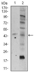 Western blot using FZD5 mouse monoclonal antibody against A549 (1), and PC-3 (2) cell lysate.