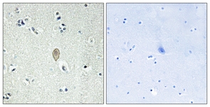 IHC of paraffin-embedded human brain tissue, using FZD5 Antibody. The sample on the right was incubated with synthetic peptide.