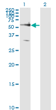 Western Blot analysis of FZD5 expression in transfected 293T cell line by FZD5 monoclonal antibody (M01), clone 6A3.Lane 1: FZD5 transfected lysate(64.5 KDa).Lane 2: Non-transfected lysate.