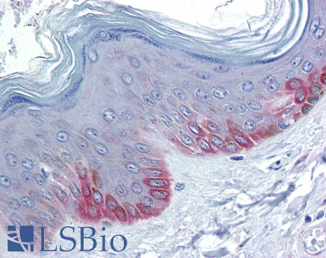 Anti-FZD5 / Frizzled 5 antibody IHC of human skin. Immunohistochemistry of formalin-fixed, paraffin-embedded tissue after heat-induced antigen retrieval. Antibody LS-B5722 concentration 10 ug/ml.