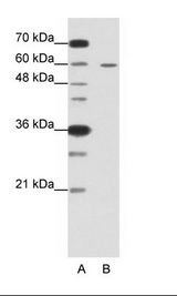 A: Marker, B: HepG2 Cell Lysate