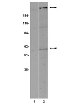 WB: TENT lysates of transiently transfected 293 cells were probed with anti-Frizzled 5 (1g/ml).