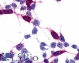 Anti-Frizzled-6 antibody LS-A4482 immunocytochemistry (ICC) staining of HEK293 human embryonic kidney cells transfected with Frizzled-6.