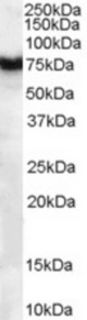 Antibody (1 ug/ml) staining of human pancreas lysate (35 ug protein in RIPA buffer). Primary incubation was 1 hour. Detected by chemiluminescence.