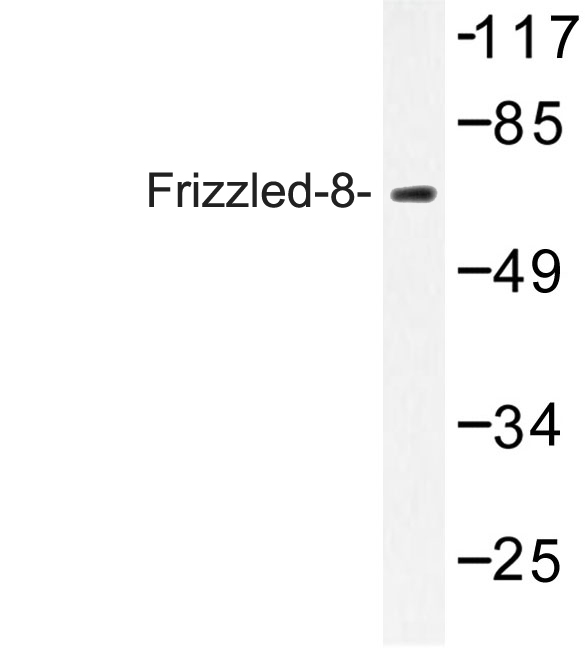 Western blot of Frizzled-8 (K528) pAb in extracts from Jurkat cells.