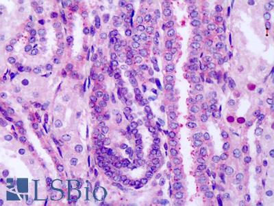 Anti-FZD8 / Frizzled 8 antibody IHC of human fetal kidney. Immunohistochemistry of formalin-fixed, paraffin-embedded tissue after heat-induced antigen retrieval. Antibody LS-A4767 dilution 8-20 ug/ml.