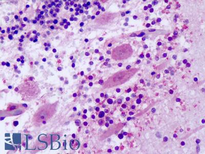 Anti-FZD8 / Frizzled 8 antibody IHC of human brain, cerebellum, Purkinje neurons. Immunohistochemistry of formalin-fixed, paraffin-embedded tissue after heat-induced antigen retrieval. Antibody LS-A4767 dilution 8-20 ug/ml.