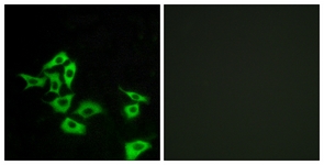 Immunofluorescence of A549 cells, using FZD8 Antibody. The picture on the right is treated with the synthesized peptide.