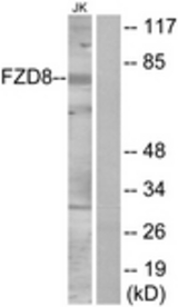 Western blot of extracts from Jurkat cells, using FZD8 Antibody. The lane on the right is treated with the synthesized peptide.