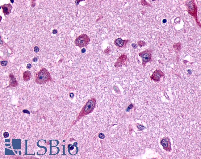Anti-FZD8 / Frizzled 8 antibody IHC of human brain, amygdala. Immunohistochemistry of formalin-fixed, paraffin-embedded tissue after heat-induced antigen retrieval.