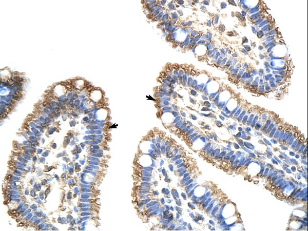 FZD9 / Frizzled 9 antibody LS-C31305 was used in IHC to stain formalin-fixed, paraffin-embedded human intestine.