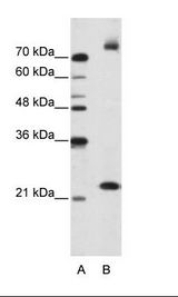 B: Jurkat Cell Lysate