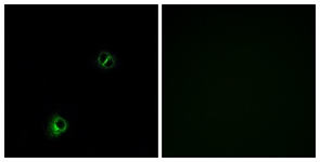 Immunofluorescence of A549 cells, using FZD9 Antibody. The picture on the right is treated with the synthesized peptide.