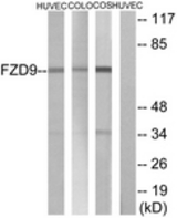 Western blot of extracts from HUVEC/COLO/COS cells, using FZD9 Antibody. The lane on the right is treated with the synthesized peptide.