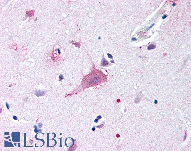 Anti-FZD9 / Frizzled 9 antibody LS-A5118 IHC of human brain, neurons and glia. Immunohistochemistry of formalin-fixed, paraffin-embedded tissue after heat-induced antigen retrieval.