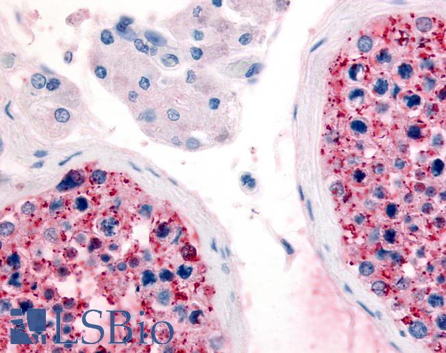 Anti-FZD9 / Frizzled 9 antibody LS-A5081 IHC of human testis. Immunohistochemistry of formalin-fixed, paraffin-embedded tissue after heat-induced antigen retrieval.