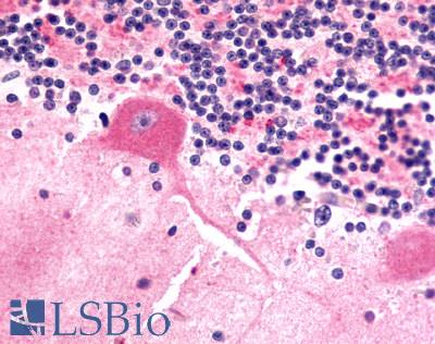 Anti-FZD9 / Frizzled 9 antibody LS-A5103 IHC of human brain, Purkinje neurons. Immunohistochemistry of formalin-fixed, paraffin-embedded tissue after heat-induced antigen retrieval.