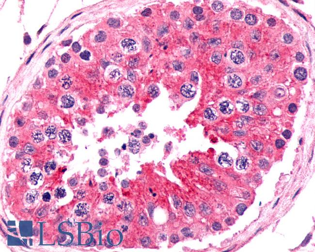 Anti-FZD9 / Frizzled 9 antibody IHC of human testis. Immunohistochemistry of formalin-fixed, paraffin-embedded tissue after heat-induced antigen retrieval.