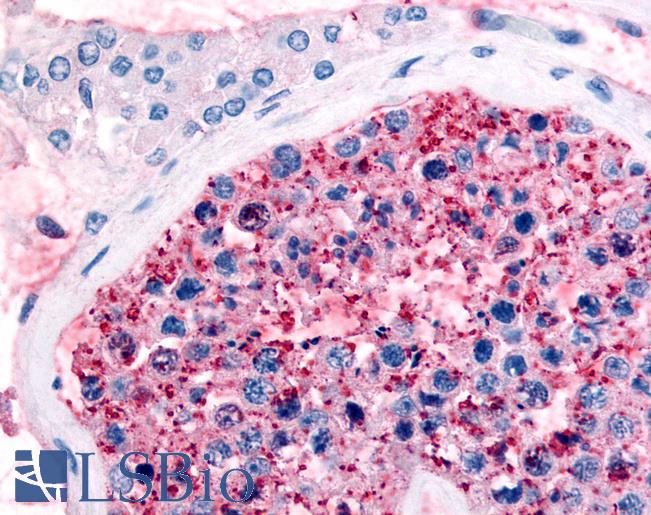 Anti-FZD9 / Frizzled 9 antibody LS-A5087 IHC of human testis. Immunohistochemistry of formalin-fixed, paraffin-embedded tissue after heat-induced antigen retrieval.
