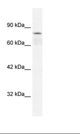 Jurkat Cell Lysate