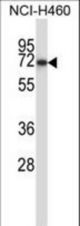 FZD9 Antibody western blot of NCI-H460 cell line lysates (35 ug/lane). The FZD9 antibody detected the FZD9 protein (arrow).