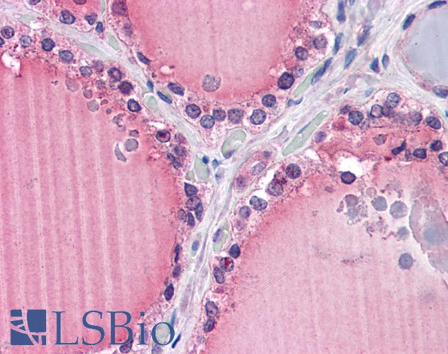 Anti-FZD9 / Frizzled 9 antibody IHC of human thyroid. Immunohistochemistry of formalin-fixed, paraffin-embedded tissue after heat-induced antigen retrieval. Antibody LS-B4374 concentration 5 ug/ml.