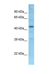 Fam170b antibody LS-C146524 Western blot of Mouse Liver lysate. Antibody concentration 1 ug/ml.