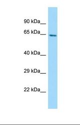 Western blot of Human HepG2. GLT25D2 antibody dilution 1.0 ug/ml.