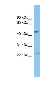FTH1 antibody LS-C116586 Western blot of HCT15 cell lysate.