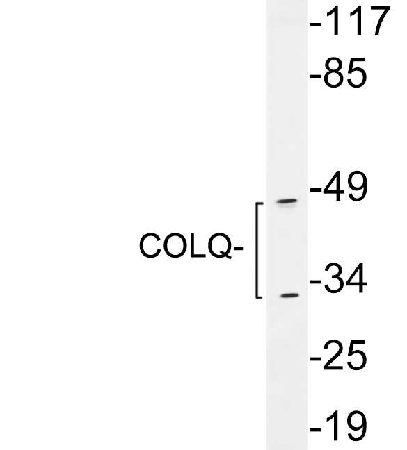 Western blot of extracts from Jurkat cells , using COLQ antibody.