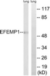 Western blot of extracts from rat lung, using EFEMP1 Antibody. The lane on the right is treated with the synthesized peptide.