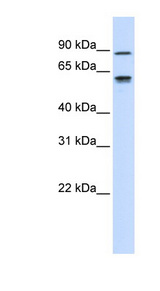EFEMP1 antibody LS-C110638 Western blot of Placenta lysate.