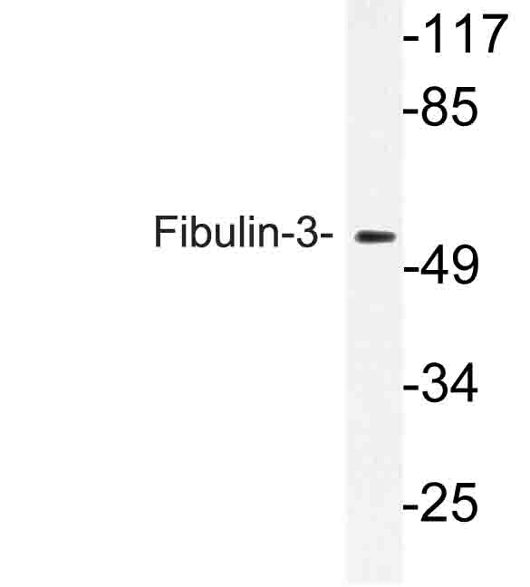 Western blot of Fibulin-3 (P150) pAb in extracts from rat lung cells.